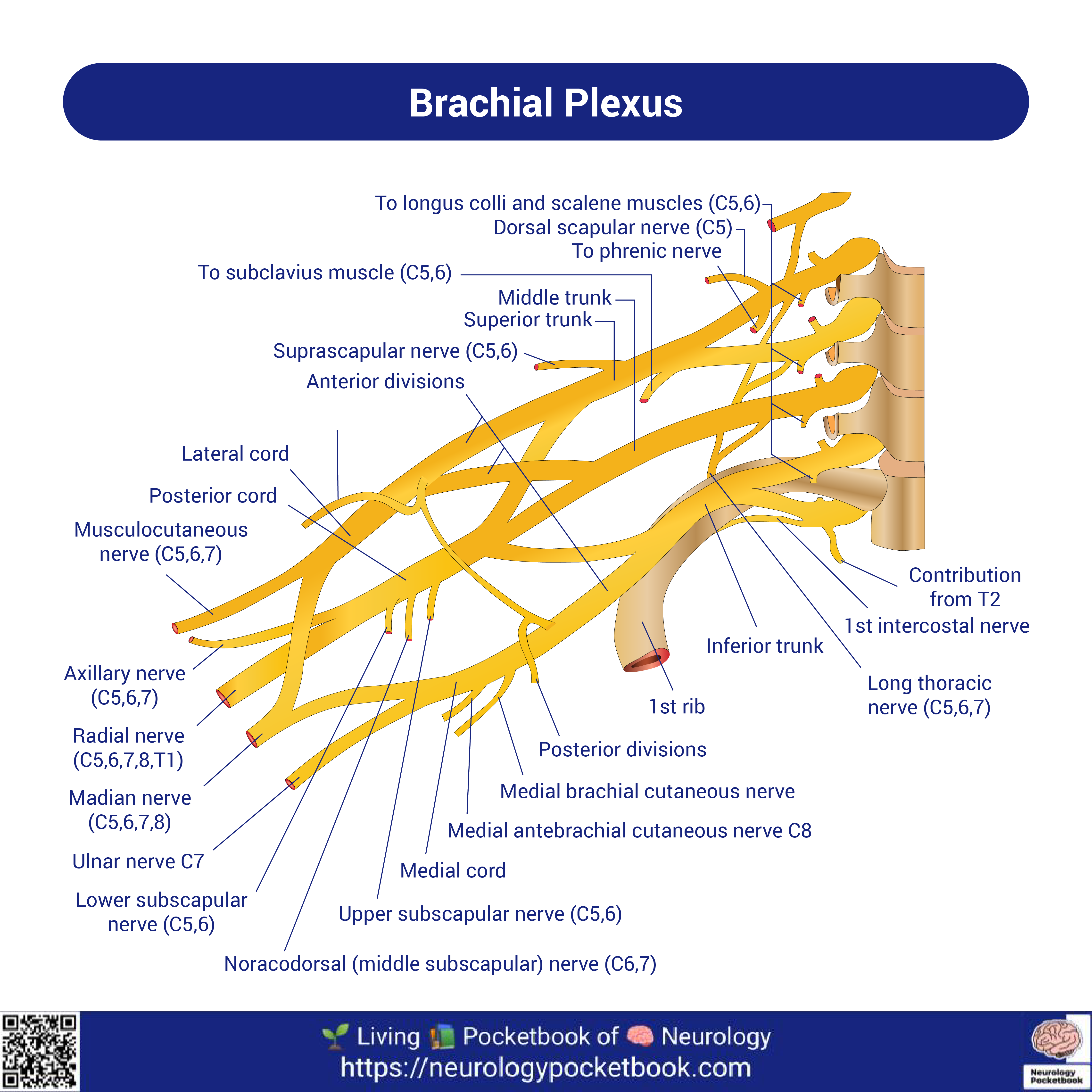 Brachial Plexopathy