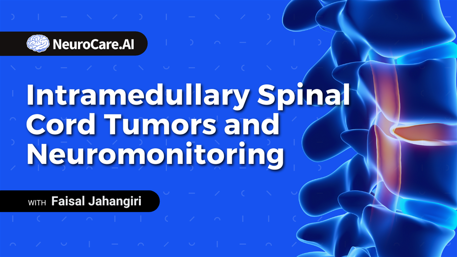 Intramedullary Spinal Cord Tumors and Neuromonitoring