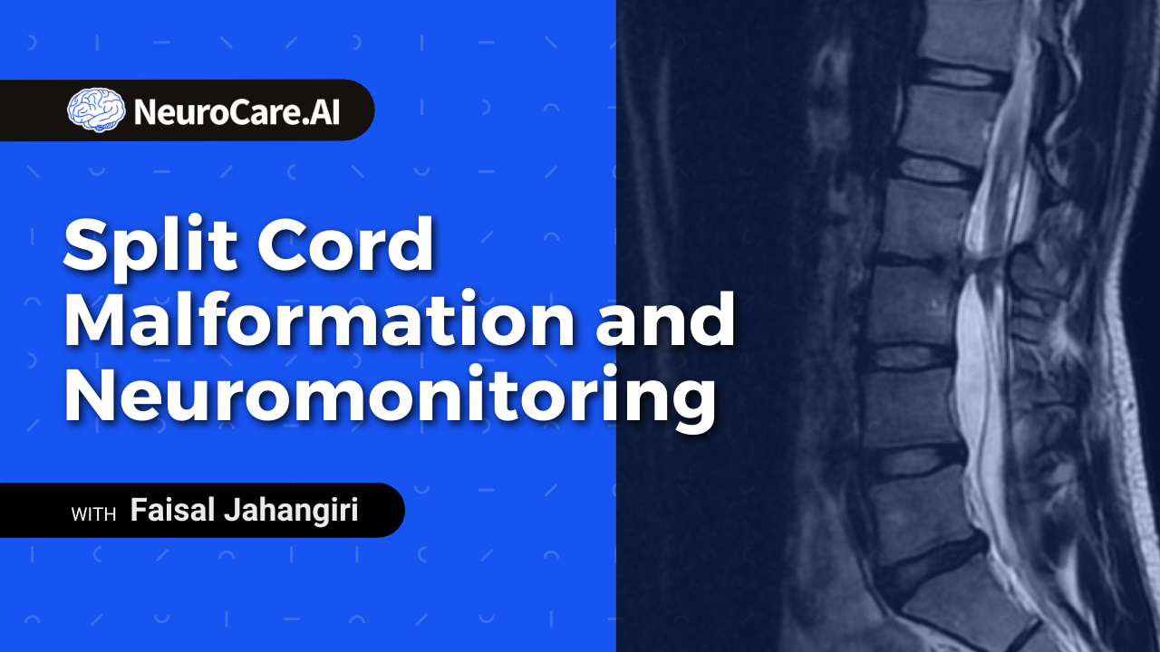 Split Cord Malformation and Neuromonitoring