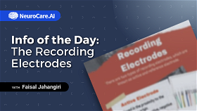 Info of the Day: "The Recording Electrodes”